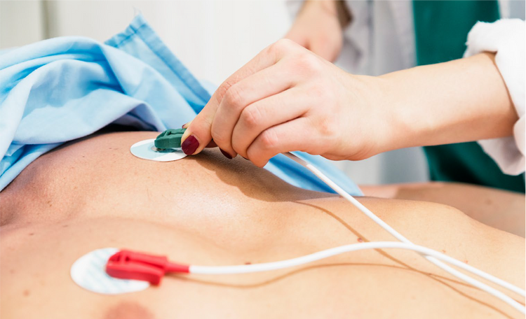 Electrocardiograms (ECGs)