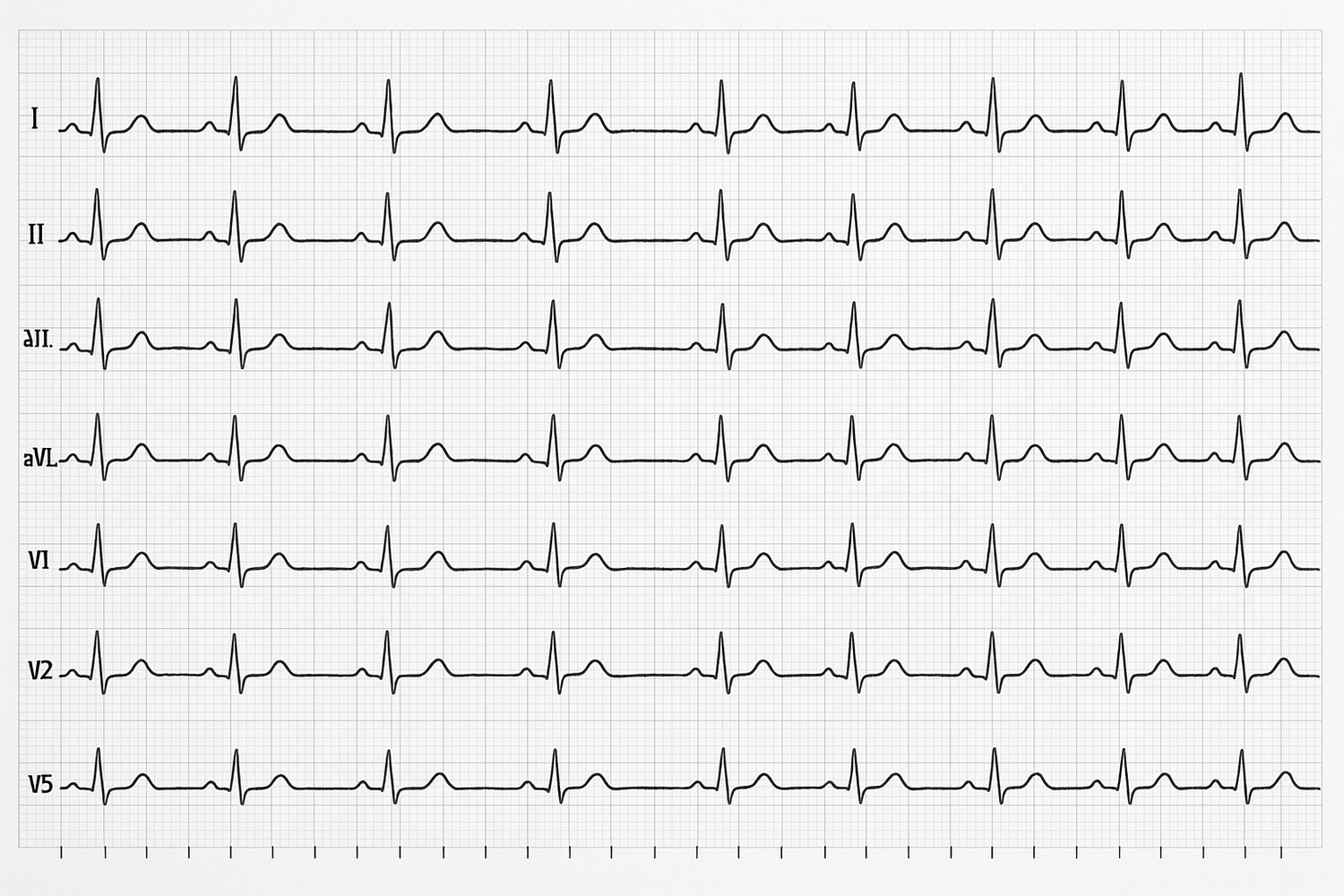 Specialty ECG Electrodes